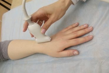 УЗИ лучезапястного сустава и кисти в Минске